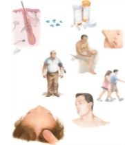 Managing Your Folliculitis