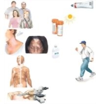 Unlabeled image