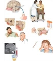 Managing Your Pituitary Adenoma