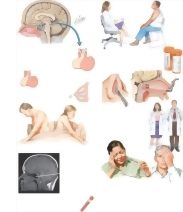 Managing Prolactinoma
