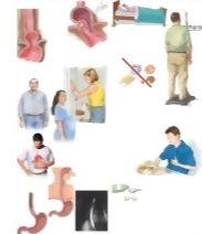 sliding esophageal hiatal hernia icd 10