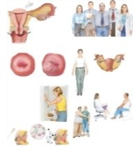 Managing Your Cervical Cancer