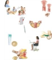 Understanding Your Options: Contraception