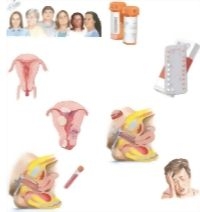 Managing Your Dysfunctional Uterine Bleeding