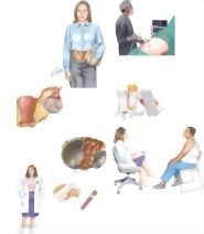 Managing Your Ovarian Cysts