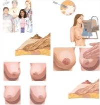 Unlabeled image