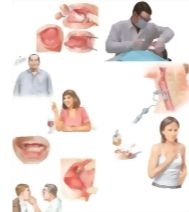 Managing Your Mouth Cancer
