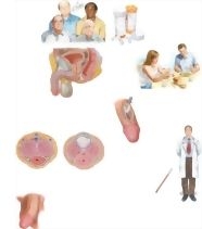 Managing Your Peyronie's Disease