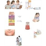 Caring for Your Child With Impetigo