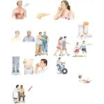Managing Your Prediabetes