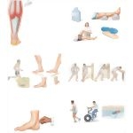 Managing Your Achilles Tendinitis