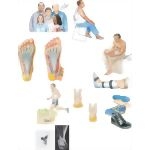 Managing Your Plantar Fasciitis