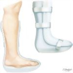 Orthotics