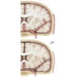 Vascular Theory Migraine: Etiology