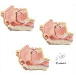 Anatomic Representation of Sleep Apnea