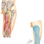 Nerves of the Thigh and Hip