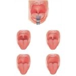 Oral Cavity Evaluation for Sleep Apnea
