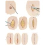 Removal of Skin Tumors