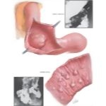 Labeled image