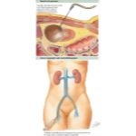 Labeled image