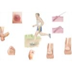 Common Problems Caused By Friction and Pressure