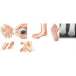 Characteristics of Rheumatoid Arthritis