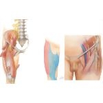 Nerve Entrapment