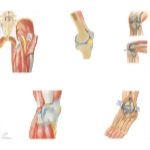 Lower Extremity Injections