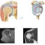 Joints of the Shoulder