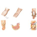 Surgical Approaches to the Arm