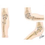Joints of the Forearm