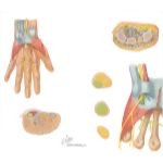 Forearm: Tunnels