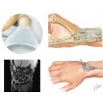 Disorders of the Forearm