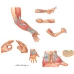 Disorders of the Forearm