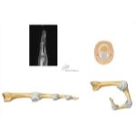 Joints of the Hand