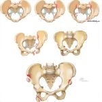 Trauma of the Pelvis