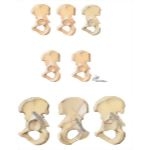 Trauma of the Pelvis