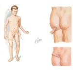 Physical Exam of the Pelvis
