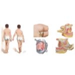 Physical Examination of the Pelvis