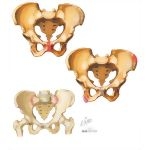 Disorders of the Pelvis