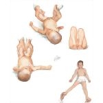 Physical Examination of the Thigh and Hip