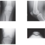 Radiology of the Leg and Knee