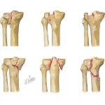 Trauma of the Leg and Knee