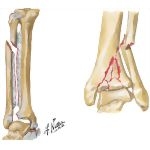 Trauma of the Leg and Knee