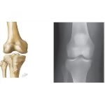 Joints of the Leg and Knee