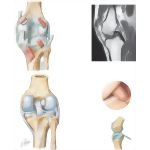 Joints of the Leg and Knee