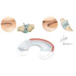Joints of the Leg and Knee