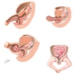 Sequence of Embryonic Gut Tube Rotations