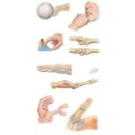 Finger Injuries