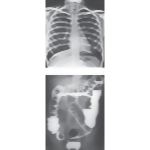 Plain (Conventional) Radiographs